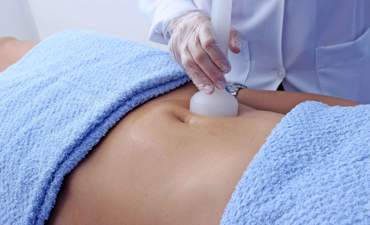 Aplicação de Endermologia corporal com sucção e rolamento controlados