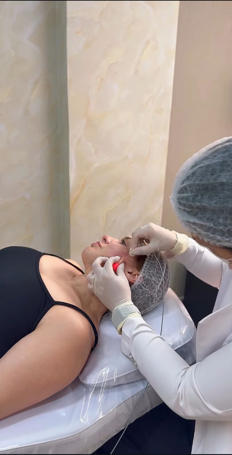 Aplicação do Endolaser Facial com tecnologia Elyon