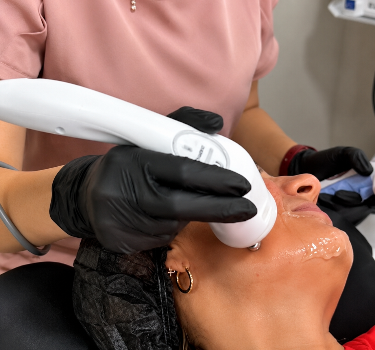 Aplicação de radiofrequência facial para estimular colágeno e melhorar a firmeza da pele