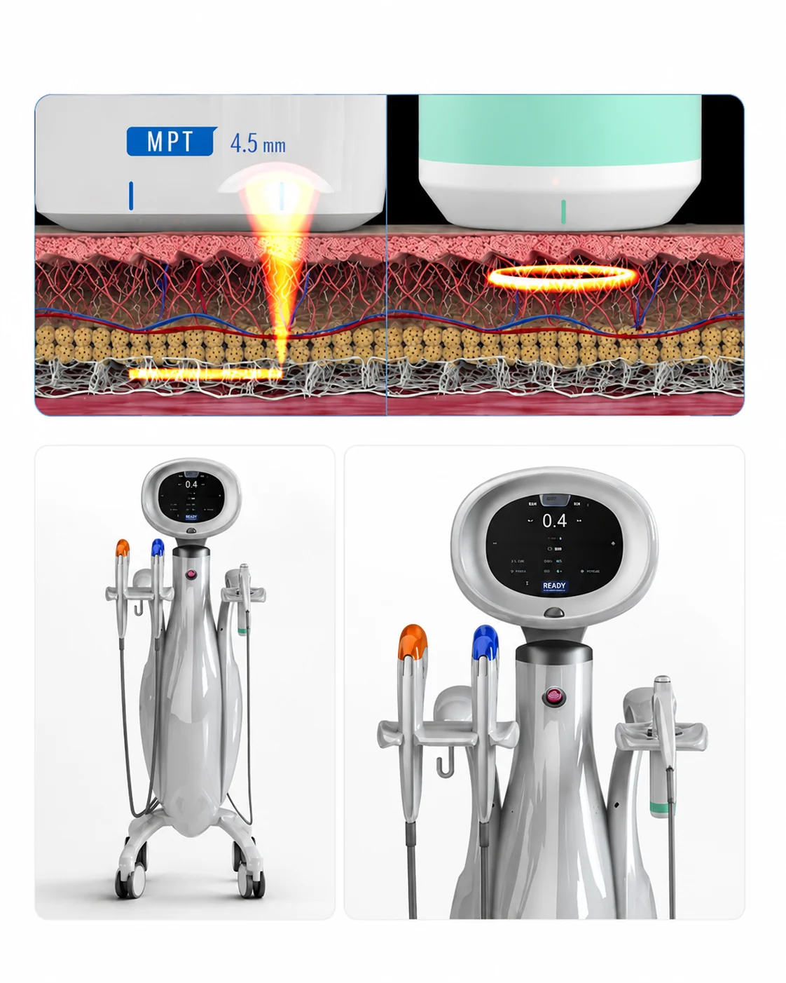 Tecnologia de ultrassom micro e macrofocado do Ultraformer MPT